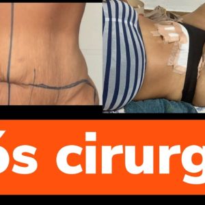 MEUS MAIORES DESAFIOS (PÓS) CIRURGIA E INÍCIO DE EXERCÍCIO