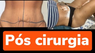 MEUS MAIORES DESAFIOS (PÓS) CIRURGIA E INÍCIO DE EXERCÍCIO