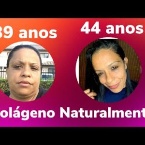 COMO EU AUMENTEI A PRODUÇÃO DE COLÁGENO NATURALMENTE