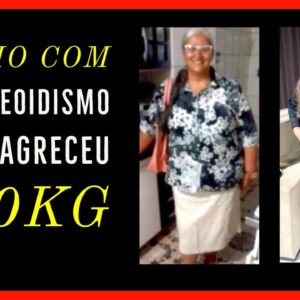 ELA COM 55 ANOS E HIPOTIREOIDISMO  EMAGRECEU 60KG naturalmente